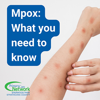 M pox fact sheet